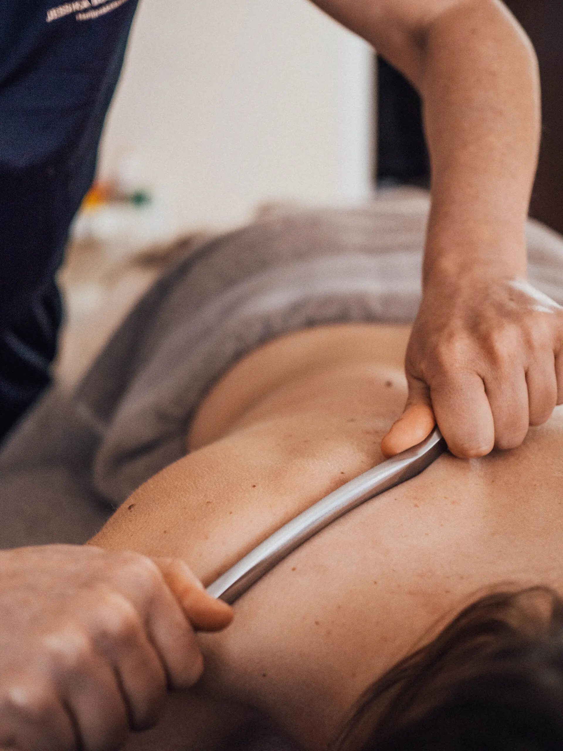 Gua Sha Behandlung am Rücken